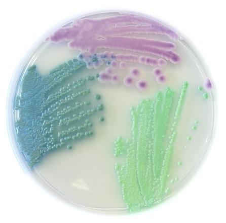 Liofilchem Chromatic Candida Selective chromogenic medium for isolating and differentiating Candida species. Candida species are often responsible of serious nosocomial and systemic fungal infections.