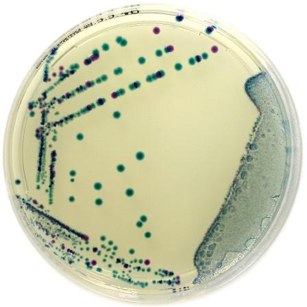 coli in water samples with low bacterial background flora to replace Lactose TTC agar in accordance to the ISO 9308-1 (effective on Sept 16th, 2014).