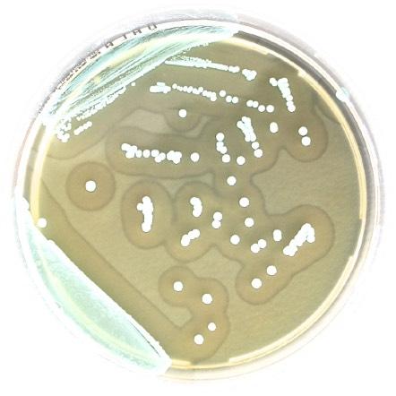 Liofilchem O.A. Listeria agar Selective differential chromogenic medium for detecting and counting Listeria monocytogenes from food samples (ISO 11290).