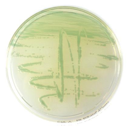 CC 35152 * 10620 500 g 610601 100 g 620601 O.A. LISTERIA supplement 81074 Liofilchem TBX agar Selective chromogenic medium for detecting and enumerating E. coli in food according to ISO 16649.