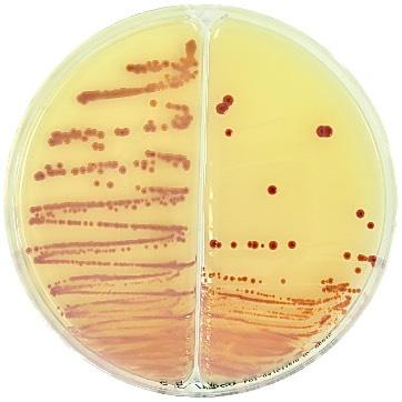 Pseudomonas strains can occasionally be isolated from the intestinal flora of humans or animals. P.