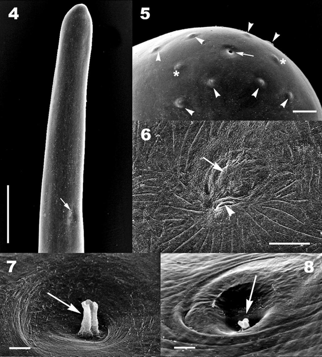 FURTADO ET AL. REDESCRIPTION OF D. IMMITIS 501 FIGURES 4 8. Dirofilaria immitis by scanning electron microscopy. (4) Anterior end, showing the vulva (arrow). Bar 5 500 mm.