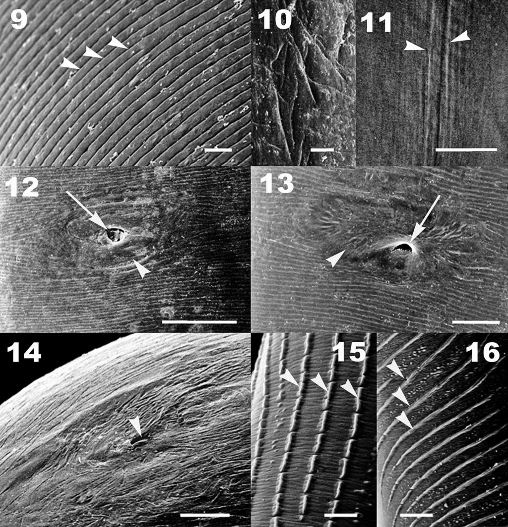 502 THE JOURNAL OF PARASITOLOGY, VOL. 96, NO. 3, JUNE 2010 FIGURES 9 16. Dirofilaria immitis by scanning electron microscopy. (9) Detail of fine transversal cuticular striation (arrow heads).