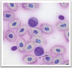 Quality of blood smear is extremely important!