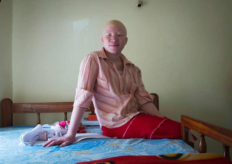 Mariam s sister, Jenipher, also has albinism. She stayed in the forest for two weeks after Mariam was attacked for fear that she was next.