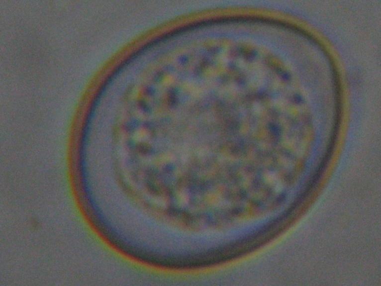 \ The dimensions of the sporulated oocysts of Eimeria susheelensis from goats are as follows: (All measurements are in microns) Particulars Oocyst from goat Length of the oocyst 27.2 38.3 (31.