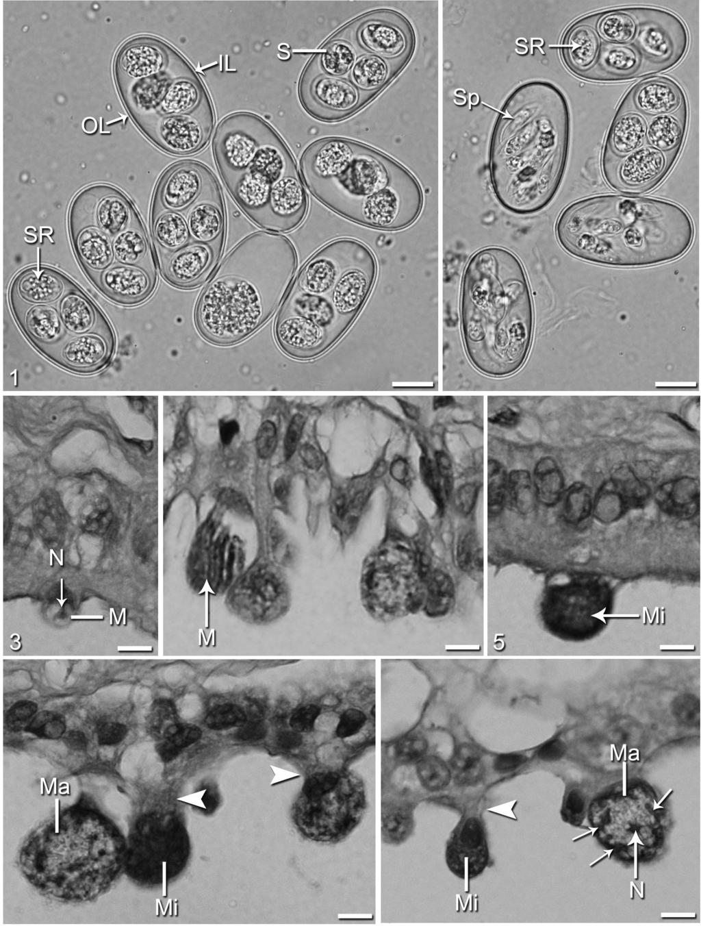 Abdel-Baki et al.: Choleoeimeria jazanensis sp. n. from Scincus hemprichii 1 2 3 4 5 6 7 Figs. 1 7. Coleoeimeria jazanensis sp. n. from the gall bladder of Sicncus hemprichii. Figs. 1, 2.