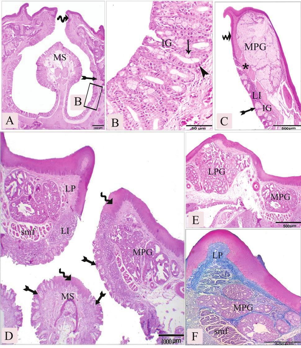 Fig (7): Photomicrograph of the narrow part of the choanal slit of laughing dove (A-C), of Japanese quail (D-F) stained with H&E, (F) stained with Masson trichrome.