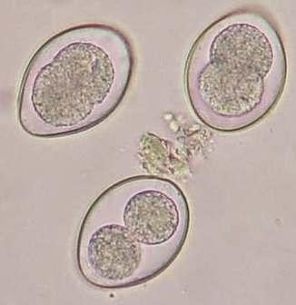 COCCIDIA Protozoan parasite that affects the intestinal tract Causes foul smelling diarrhea, lack of nutrient absorption, weight loss, lack of appetite Can be fatal if undectected or left