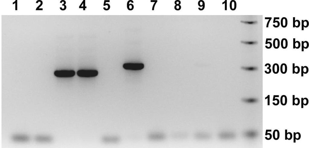 Michael et al. 123 Figure. 2 SCCmec characterization by PCR. SCC mec type III PCR is shown in lanes 1-5. SCC mec type V PCR is shown in lanes 6-10.