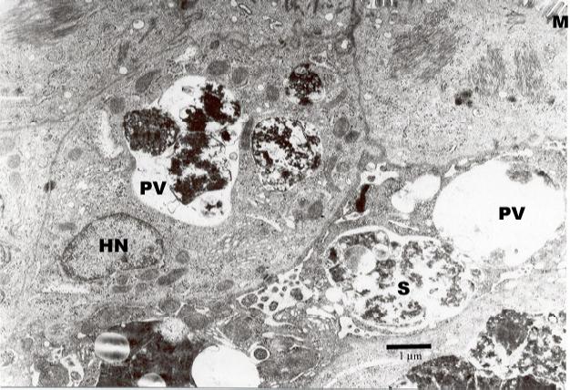 Fig. 1. Electron micrograph of caecum from chicks experimentally infected with E. procera.