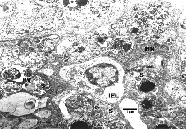 host nucleus (HN), and covered by microvilli (M) 12 h pi. Bar: 1 µm. Fig. 2.
