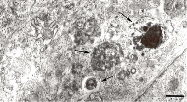 post-infection with E. procera Bar: 2 µm. Fig. 6. Three first generation schizonts (arrows) with degenerated merozoites located in the epithelial cell of caeca 60 h pi. Bar: 2 µm. DISCUSSION Virulence of coccidia reflects a number of factors.