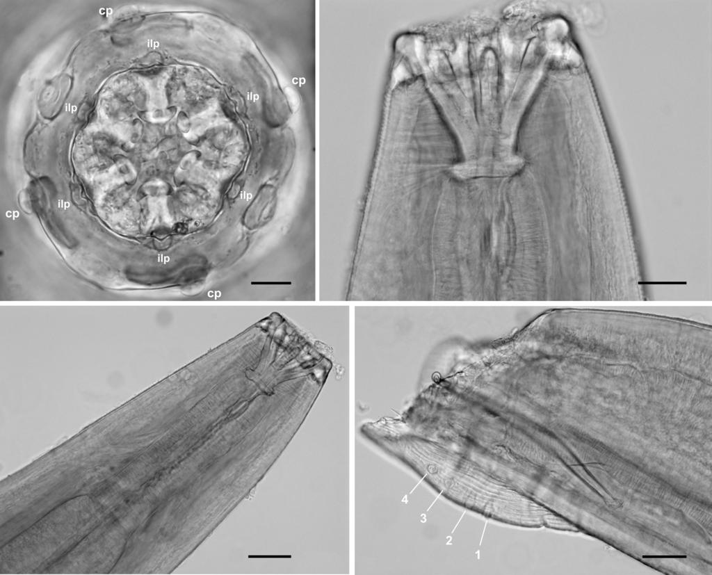 Junker et al.: New species of Cylicospirura from African carnivores A B 20 µm 50 µm C D 100 µm 100 µm Fig. 4. Cylicospirura pardalis sp. n. from Panthera pardus.