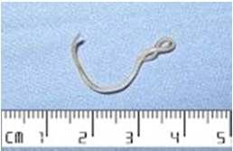 Common helminths Roundworm Hatch/live in intestines Symptoms fatigue, Weight los