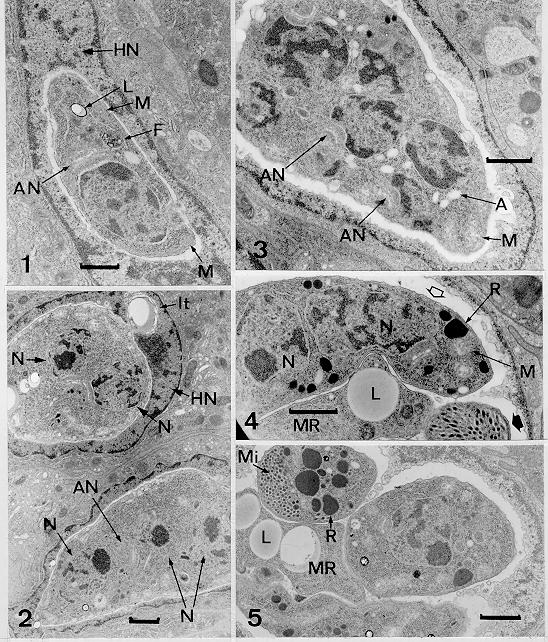 Mem Inst Oswaldo Cruz, Rio de Janeiro, Vol. 95(1), Jan./Feb. 2000 45 Intranuclear merogony stages of Isospora hemidactyli in Hemidactylus mabouia. Fig. 1: young, elongated meront. Fig. 2: rounded, dividing meronts.