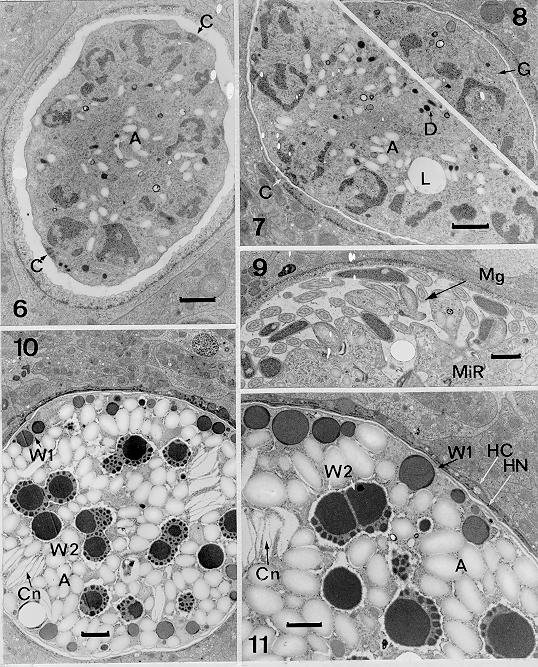 46 Ultrastructure of Endogenous Stages of I. hemidactyli I Paperna, R Lainson Gamogony stages of Isospora hemidactyli. Figs 6-8: differentiating microgamonts. Fig. 9: microgametes on the microgamont surface.