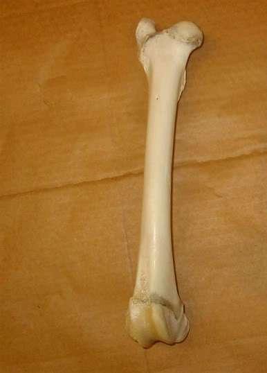 On the inside of the thigh he will be able to feel the thigh bone (femur).