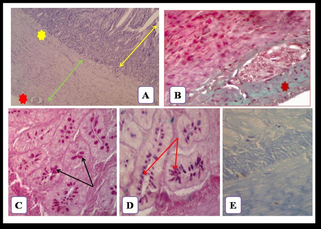 Fig 3: Cross section in the duodenum wall of Ruddy showed mucosa (yellow double head arrow), submucosa (yellow star), muscularis externa (green double head arrow), serosa (red and brown star),