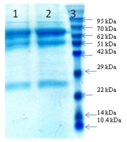 Biochemical Characterization of Cystic Fluid Antigens of. 932 SDS-PAGE was performed as per the method described by Laemmli (1970) in 12 % polyacrylamide gel and 4 % stacking gel.