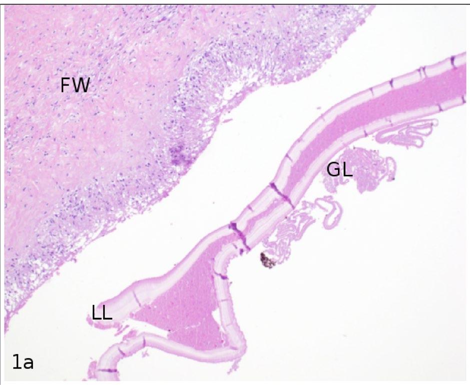 K. Kurz et al. Fig. 3 Histologic stains of the resected mass with legends.