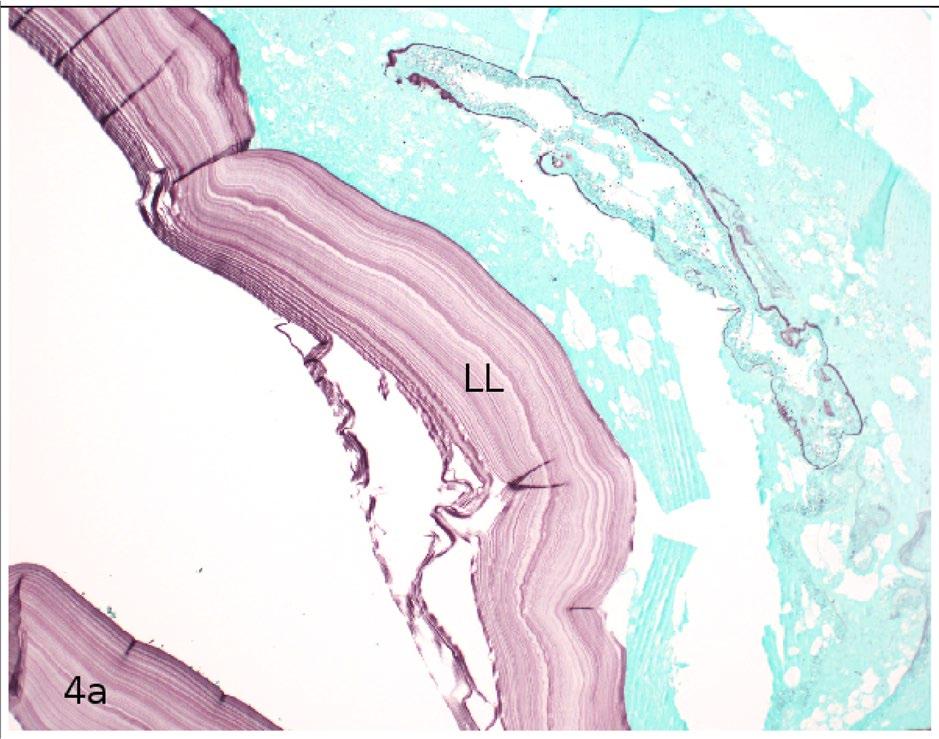 K. Kurz et al. Fig. 3 (continued) 4a Groco Gomori methenamine stain, 100x magnifica on, outlining the laminated layer (LL).