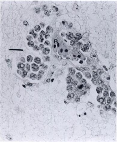 of intestinal architecture, with hyperplastic enterocytes occupied generally by gametogenous coccidial stages, although epithelial schizonts were occasionally observed (Fig. 1).
