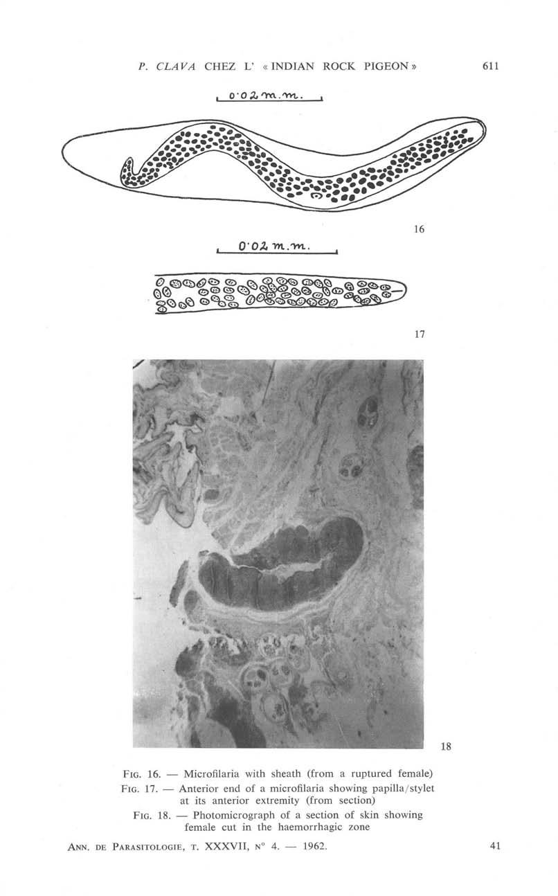 P. CLAVA CHEZ L «INDIAN ROCK PIGEON» 611 16 17 Fig. 16. Microfilaria with sheath (from a ruptured female) Fig. 17. Anterior end of a microfilaria showing papilla/stylet at its anterior extremity (from section) Fig.