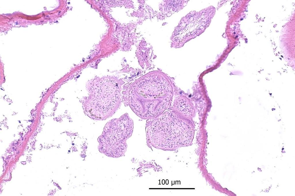 0 0 0 0 0 0 Figure : Histological presentation of the fertile parasitic lesions recovered