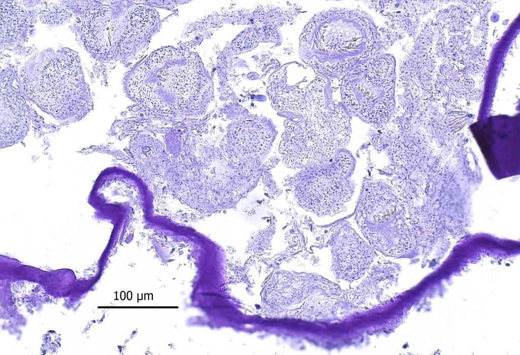 an intravesicular protoscolex; B: PAS-stained section (x00), arrow no.