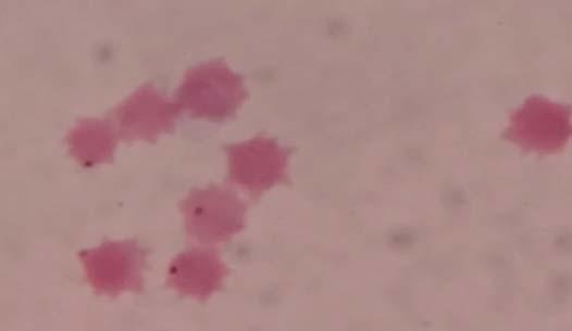 Anaplasmosis outbreaks in dairy cattle parasitologicaly positive animals, 6 were exhibiting severe jaundice and fever. Fig. 1: Microphotograph of A.