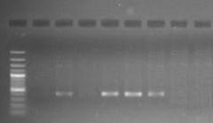 A total of 11 samples were found positive for A. marginale DNA as evident from agarose gel (1.5%) electrophoresis showing 407 bp fragment of amplified DNA/PCR product (Fig. 2).