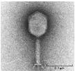 1975: Woese classifies living organisms in 3 domains: Eukaryotes, Bacteria, Archae XVII century: van Leeuwenhoek