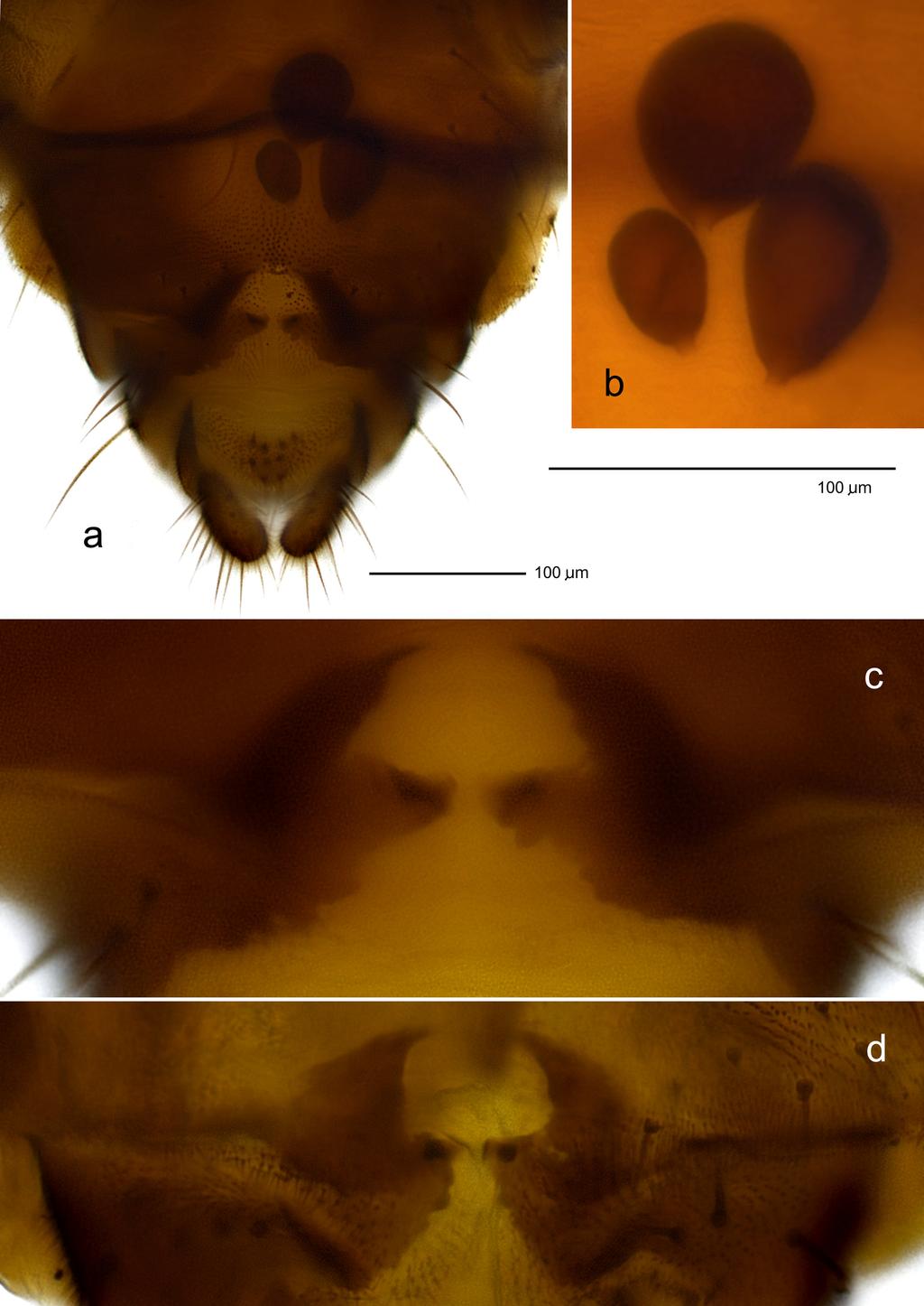 FIGURE 6. Ceratopogon azari sp. nov., female: a. distal abdominal segments in ventral view; b.