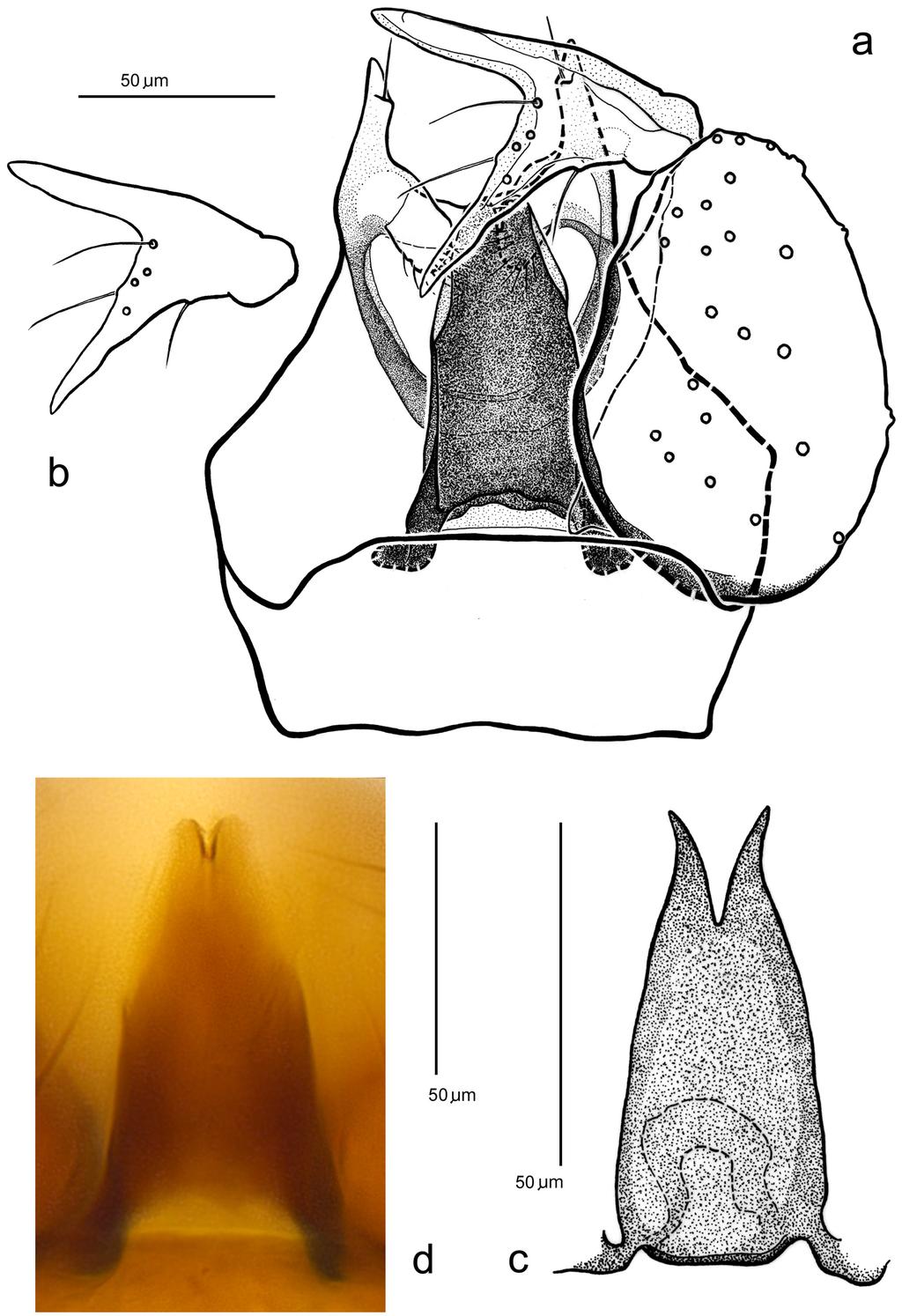 FIGURE 2. Brachypogon freidbergi sp. nov., holotype male: a. male genitalia in ventral view, b.