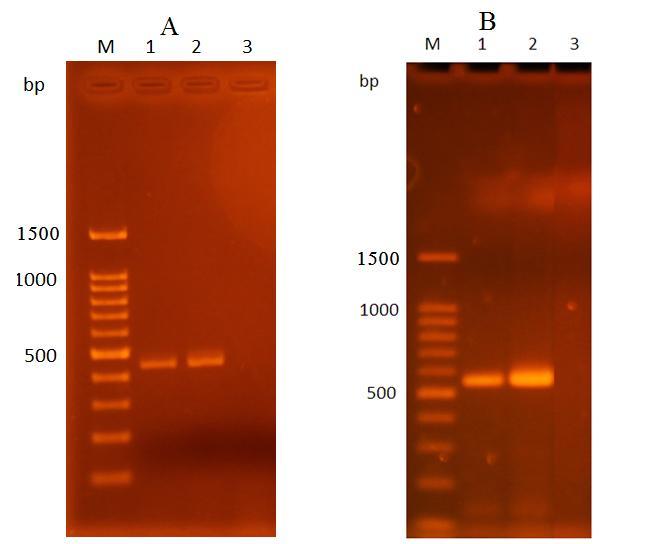 33 Figure 3.4. PCR of DNA amplification products targeting C. tenuicollis DNA. Panel A, PCR products of (Cox 1) gene; Panel B, PCR products of (rrns) gene.