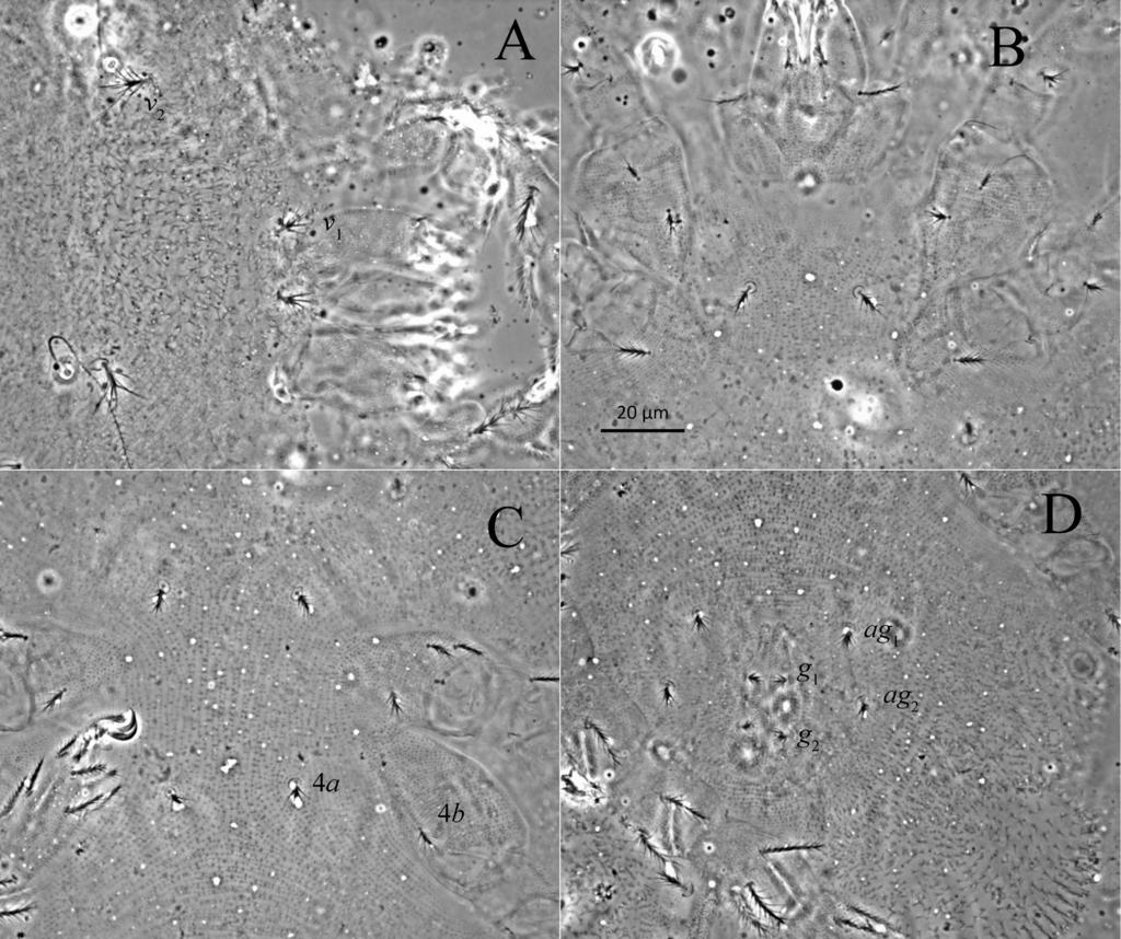 A new genus of Eupodidae Fig. 10. Phase-contrast micrographs of Echinoeupodes echinus sp. n., deutonymph: A prodorsum, B sternocoxal fields I-II, C sternocoxal fields III-IV, D genital area. (2ω, ε).