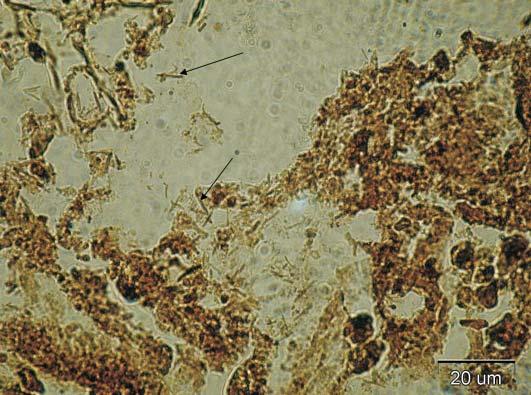 Fig. 4. Numerous Helicobacter organisms visible in the gastric mucosa. Warthin-Starry, 100, scale bar = 20 μm 2. 96-4.97 μm in length and 0.45-0.76 μm in width.