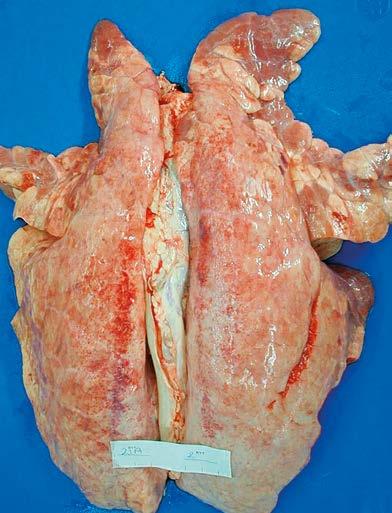 Lungs Enzootic pneumonia-like lesions (EP-like) Darkened purple/grey areas Rubbery areas Heavily diseased lungs show a larger proportion of damage Totally diseased: Score 10 for each cranial and
