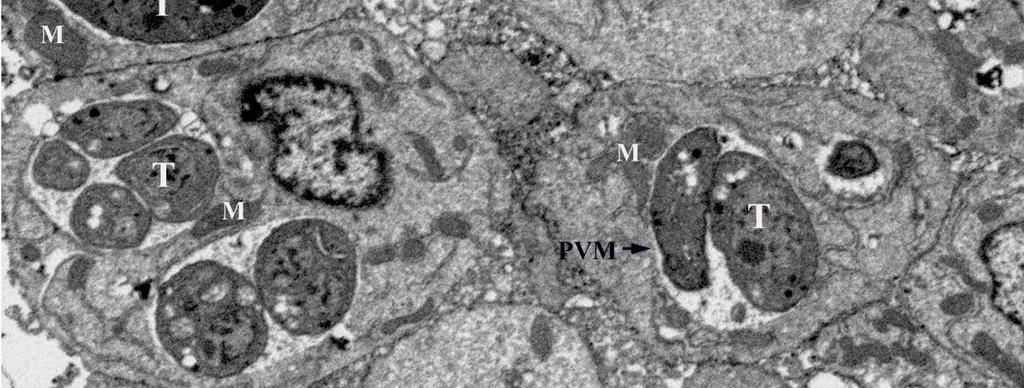 Hepatocyte with two parasitophorus vacuoles filled with tachyzoites (T). Numerous mitochondria (M) are located in the perinuclear region and in association with the PVM.