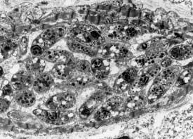 Fig. 3: Low-magnification electron micrograph of intramyocardial tachyzoites (T). Note a dividing zoite ( ). MF = myofibril. 8775. Fig.