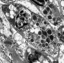 5: Tachyzoite showing a conoid (C) and a vesiculo-membranous organelle (V). R = rhoptries, G = dense granules, Mn = micronemes. 23 571.
