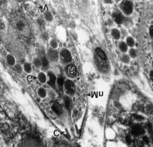 completely electron-dense although the internal structure was very dark and indistinct (Fig. 7), unlike the rhoptries typical of Toxoplasma gondii which are clearly labyrinthine 19.