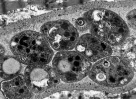 Fig 6: High-magnification electron micrograph of a portion of an intracellular cyst containing several cross-sections of bradyzoites (B).