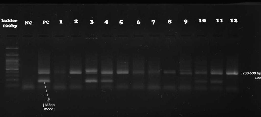 Nasal Carriage MRSA with meca Gene among Healthy Primary School Boys Fig.2: Agarose gel showing the strains containing spa and meca genes.