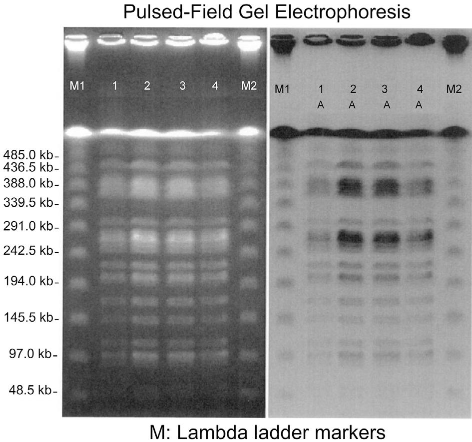 Figure 2. The patient s clinical course. pulsed-field gel electrophoresis pattern, indicating that all four samples were from the same molecular epidemiological source (Fig. 3). Discussion Figure 3.