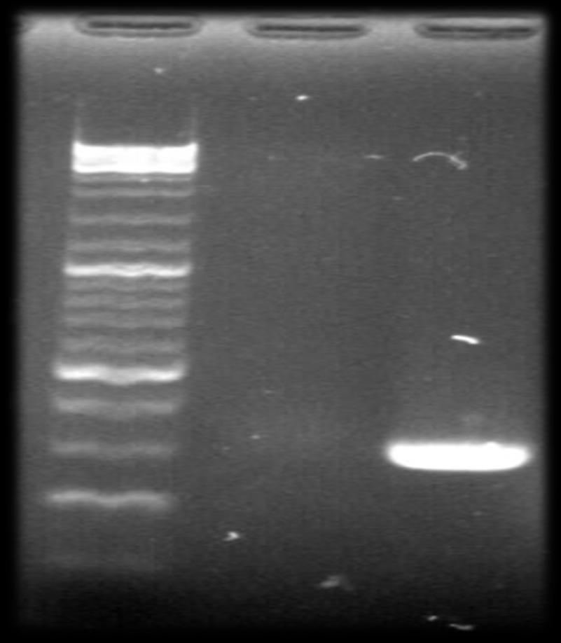 Detection of Oxa 51gene in A.