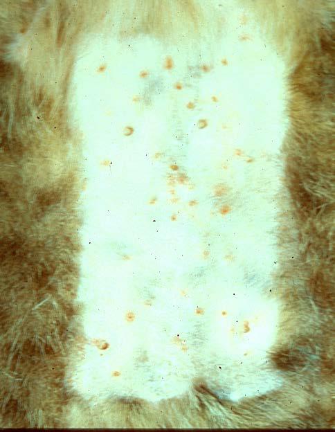 Eosinophilic Reactions Miliary dermatitis