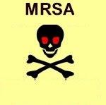 Methicillin-resistant Staphylococcus aureus (MRSA) in Veterinarians Emerging as a problem in vet med MRSA carriage 1.