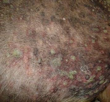 What to culture Pustules Under epidermal